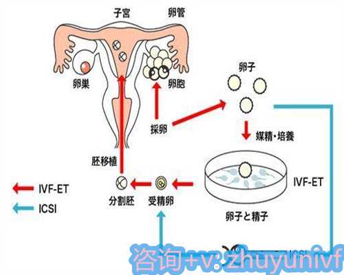 三代试管婴儿成功率与潜在风险分析